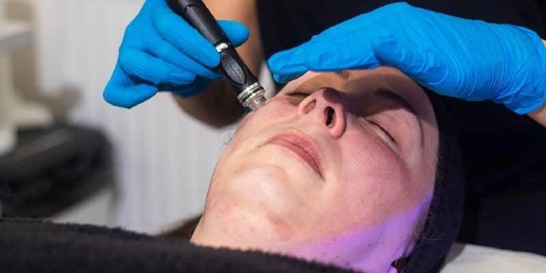 Hydrafacial-For-Hyperpigmentation-copy-2